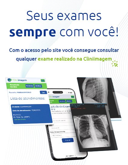 Banner site resultados - mobile 2